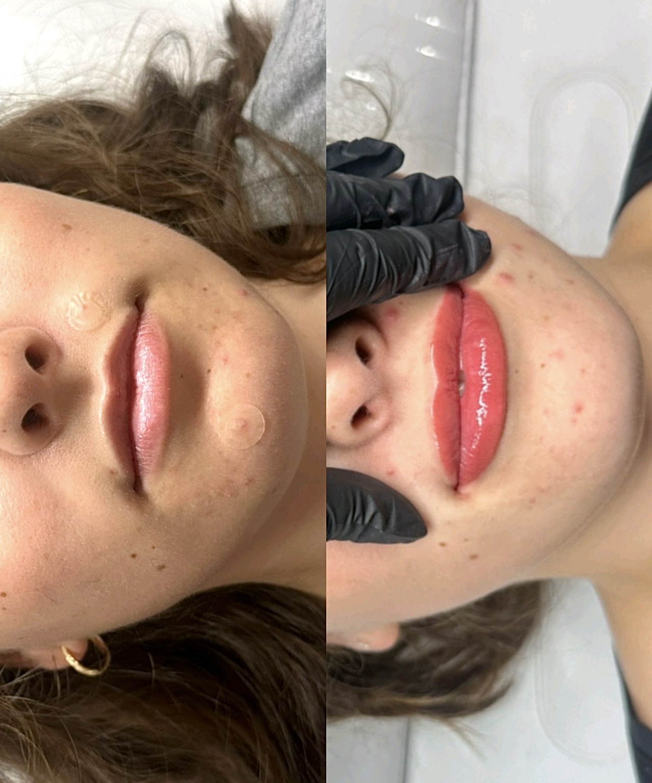 Cloud Fine Aesthetics treatment detail