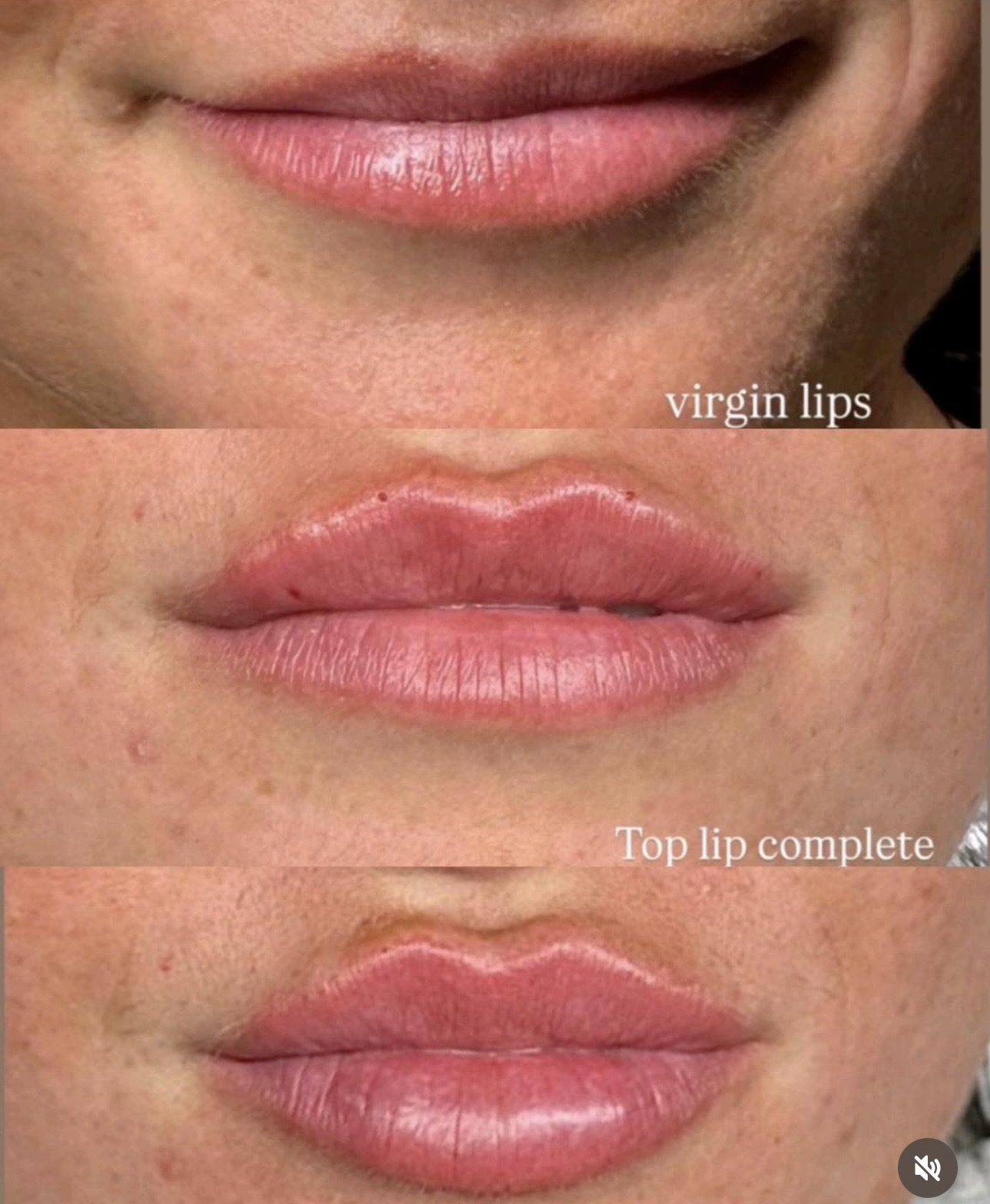 Cloud Fine Aesthetics treatment detail